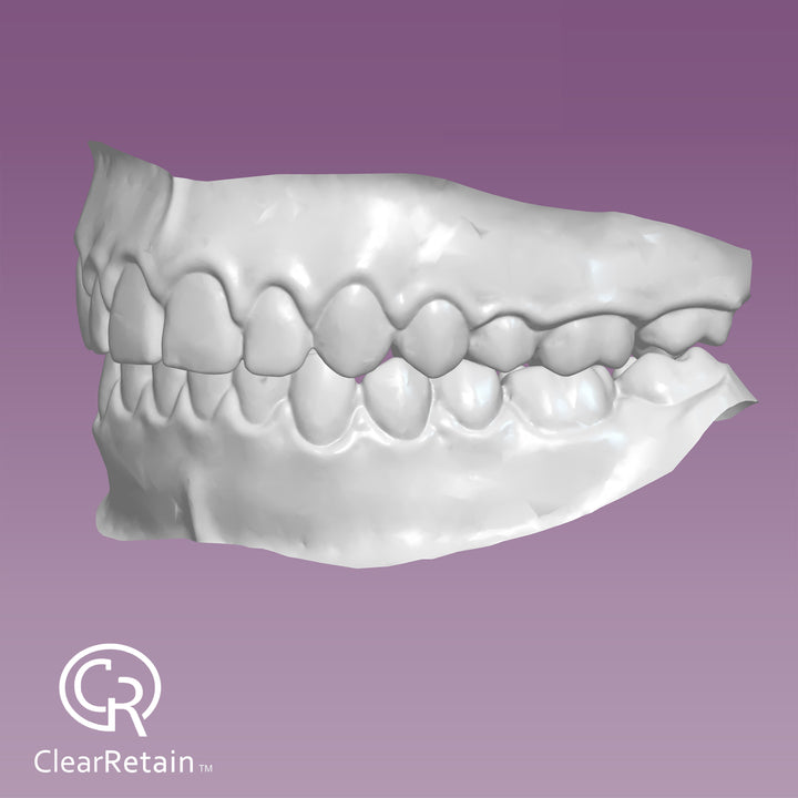 Add backup retainer for 80% Off + get "File Your Smile" for free!