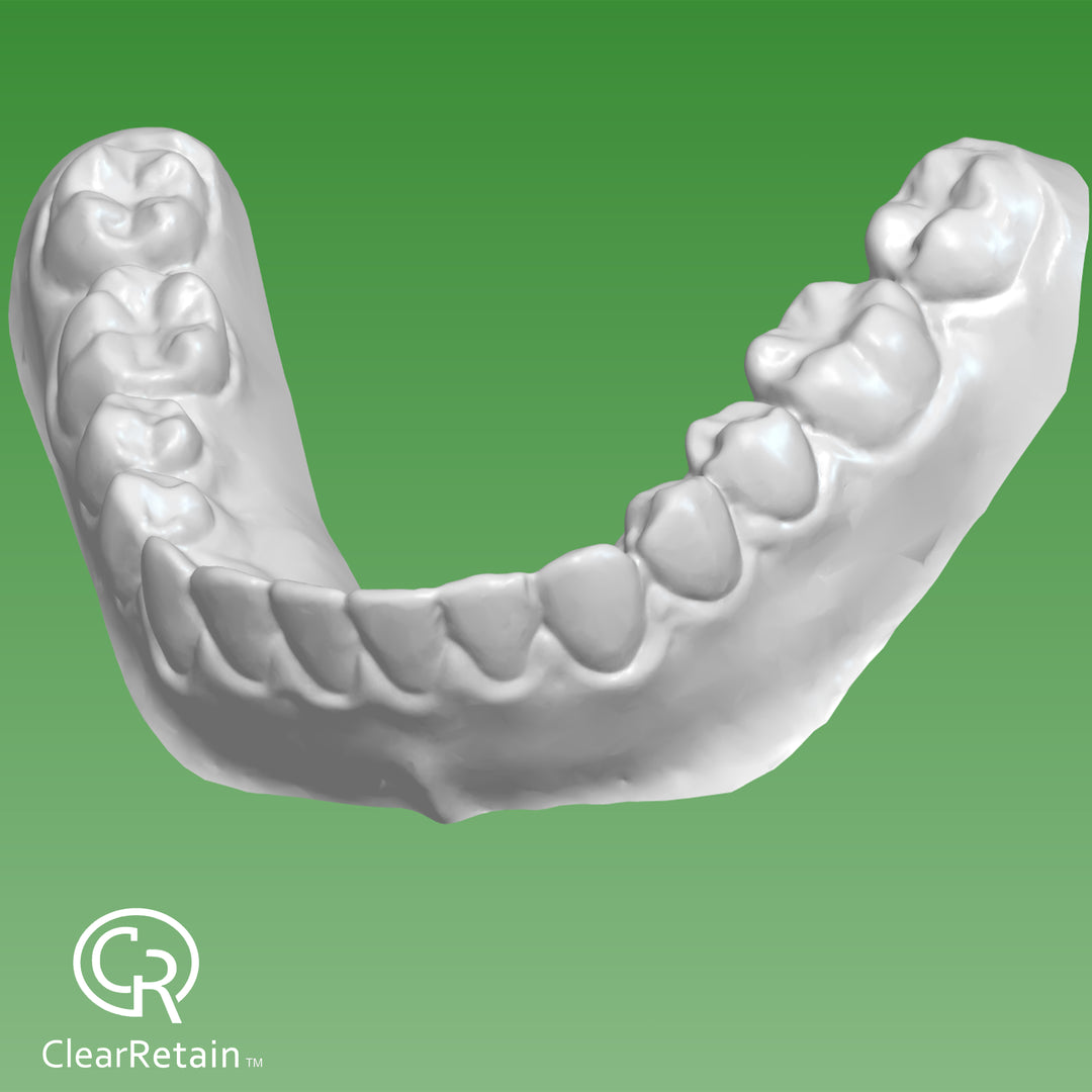 File Your Smile (A Digital Copy of Your Impressions For Future Replacement Products)