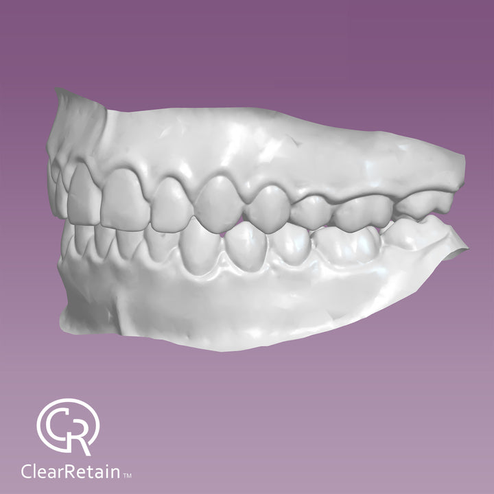 File Your Smile (A Digital Copy of Your Impressions For Future Replacement Products)