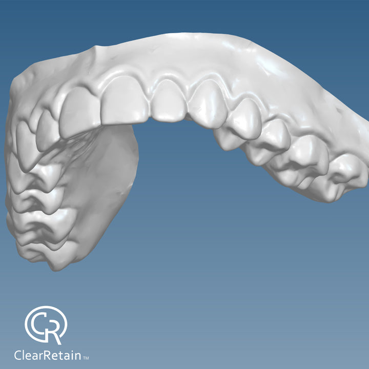 File Your Smile (A Digital Copy of Your Impressions For Future Replacement Products)