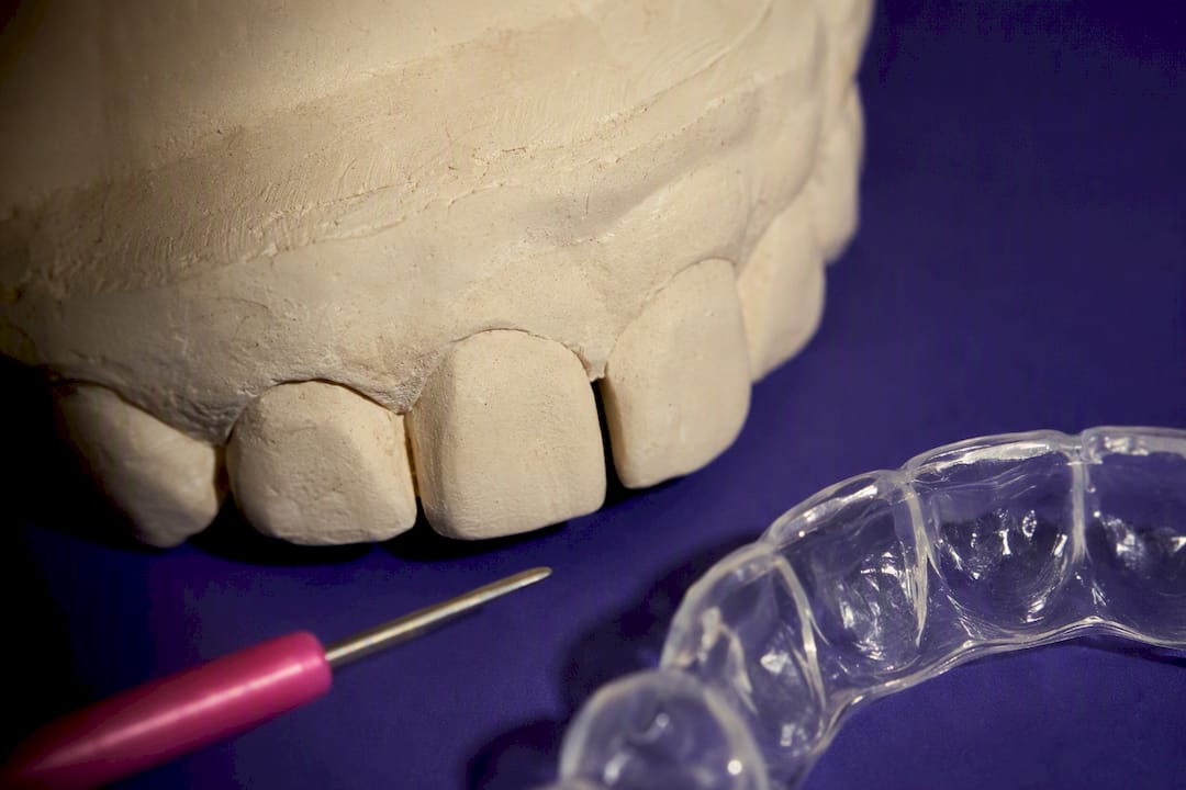 Dental model showing a small front tooth gap