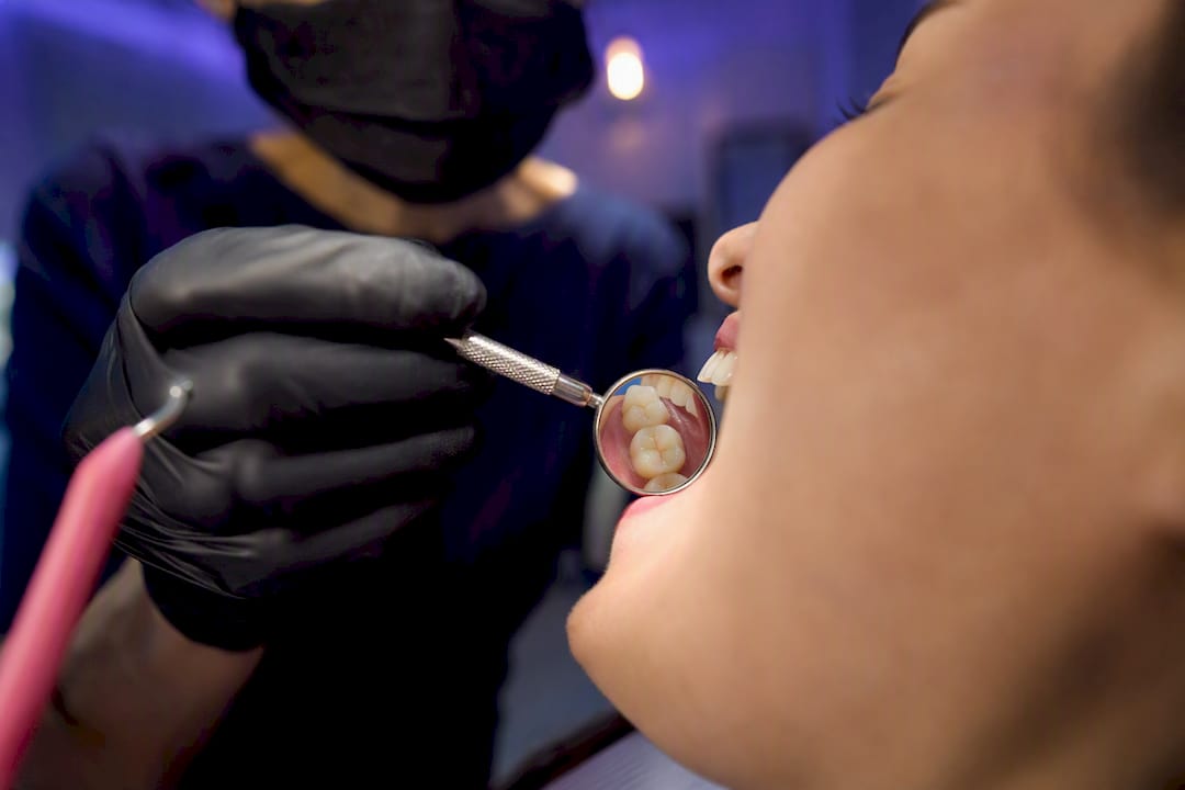 Dentist examining tooth wear for grinding