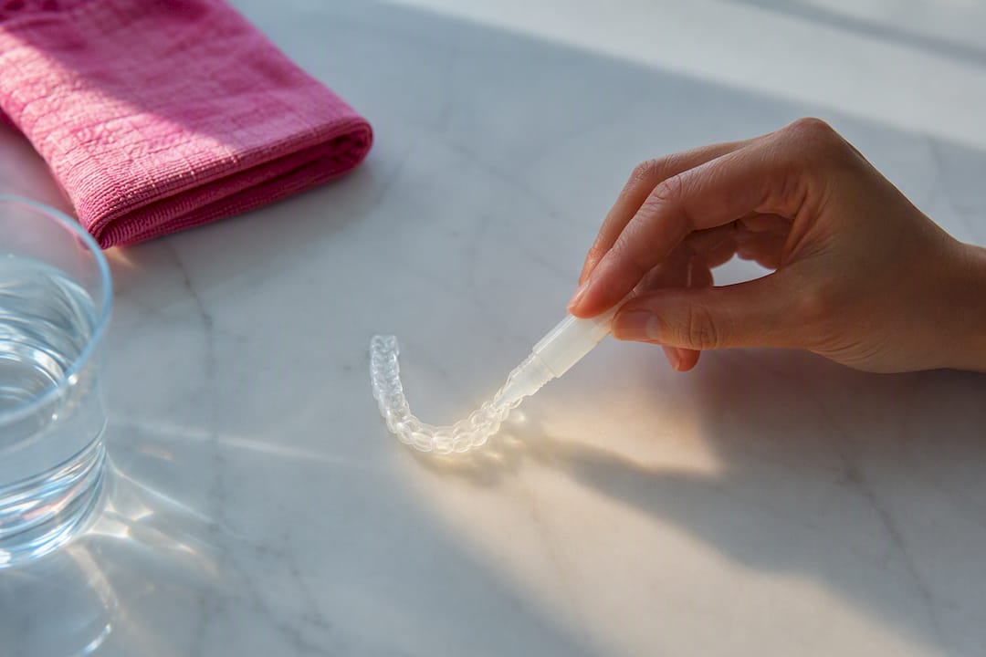 Applying whitening gel to a dental tray