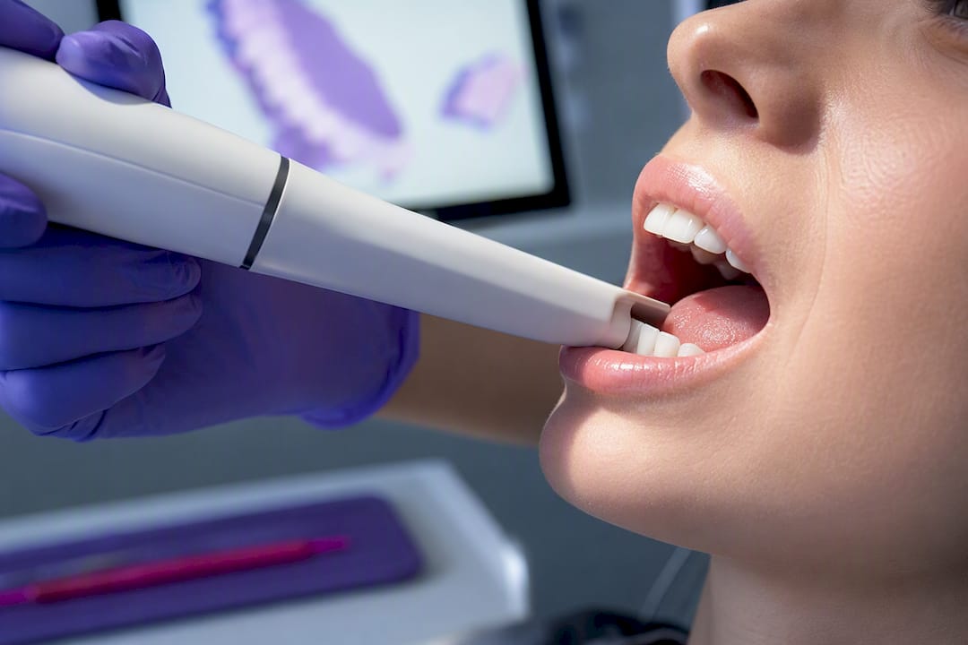 Digital dental scan during retainer reorder