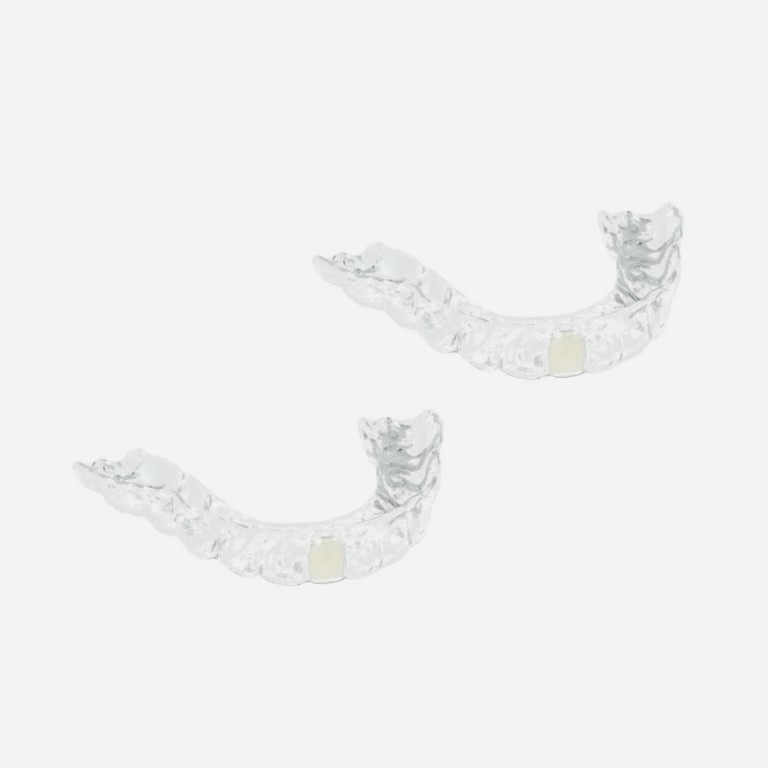Lower Partial Denture Retainer (1 Tooth Only)