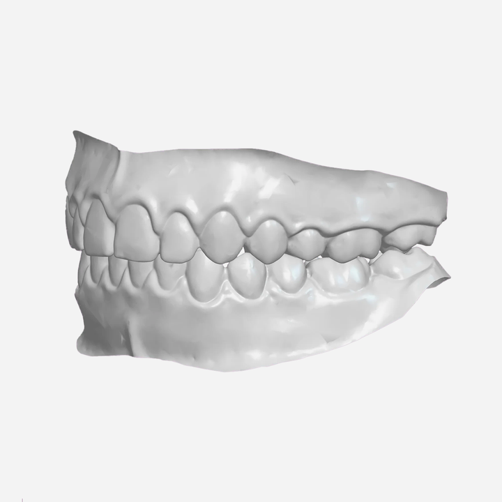 File Your Smile (A Digital Copy of Your Impressions For Future Replacement Products)