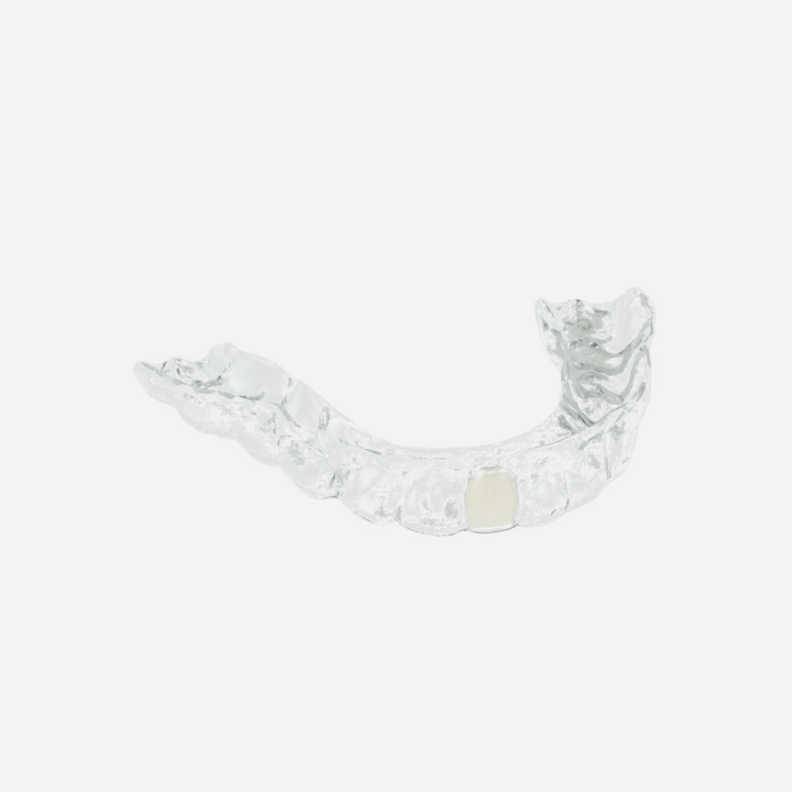 Lower Partial Denture Retainer (1 Tooth Only)