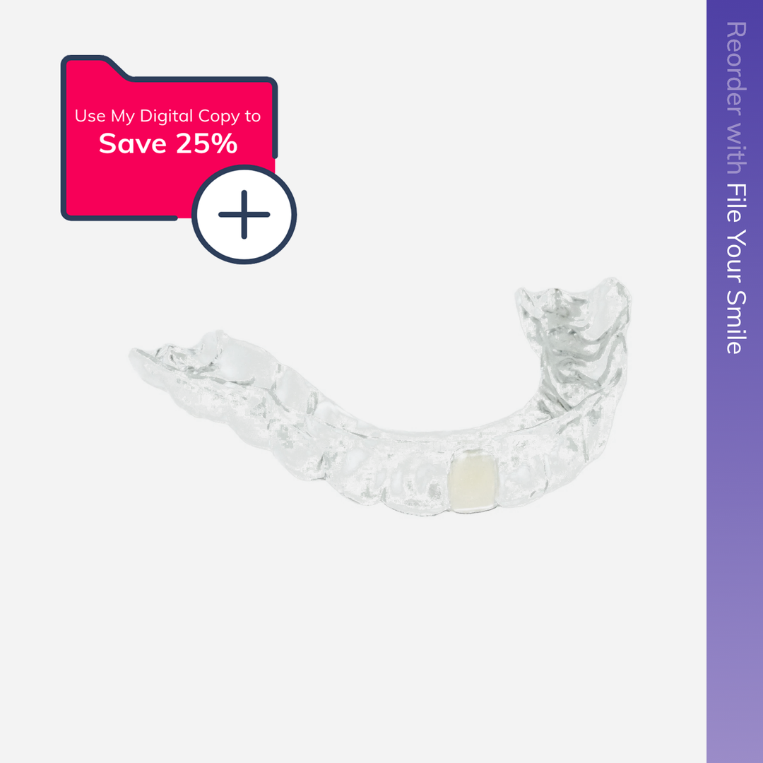 REORDER-Lower Partial Denture Retainer (1 Tooth Only)